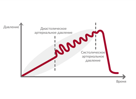 Восходящая накачка давления